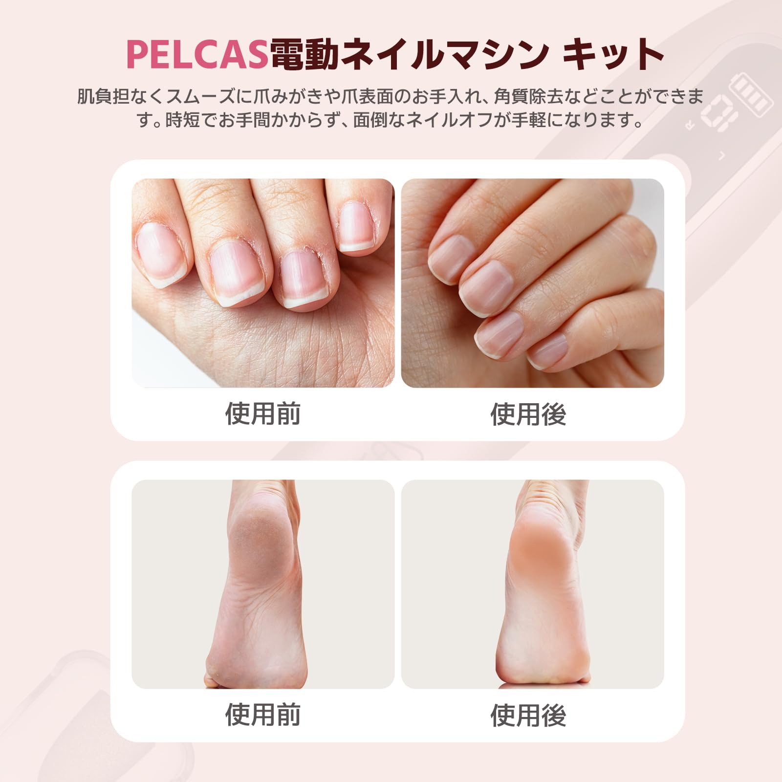 Amazon.co.jp: PELCAS電動ネイルマシン 10個のビット ネイルマシーン